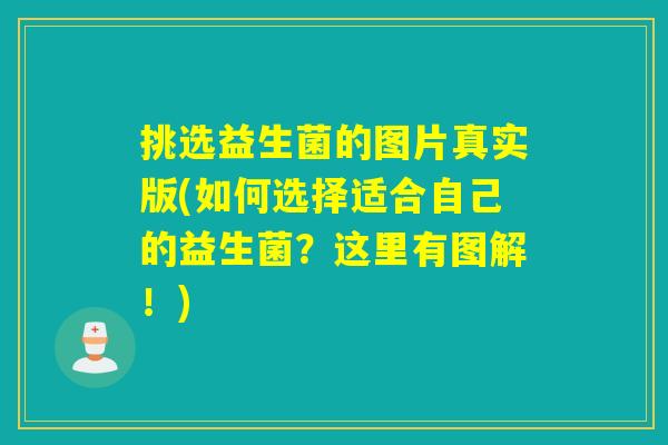 挑选益生菌的图片真实版(如何选择适合自己的益生菌?这里有图解!) 挑选益生菌的图片真实版(如何选择适合自己的益生菌?这里有图解!)
