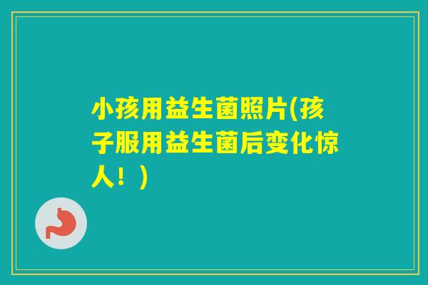 小孩用益生菌照片(孩子服用益生菌后变化惊人！)