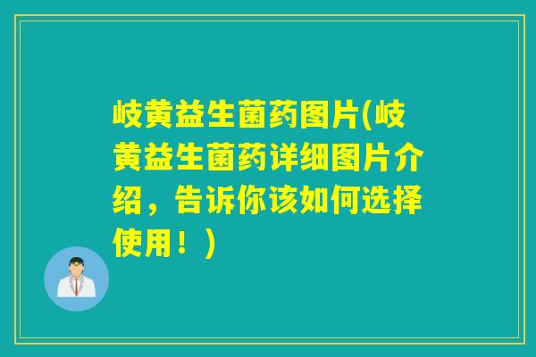 岐黄益生菌药图片(岐黄益生菌药详细图片介绍，告诉你该如何选择使用！)